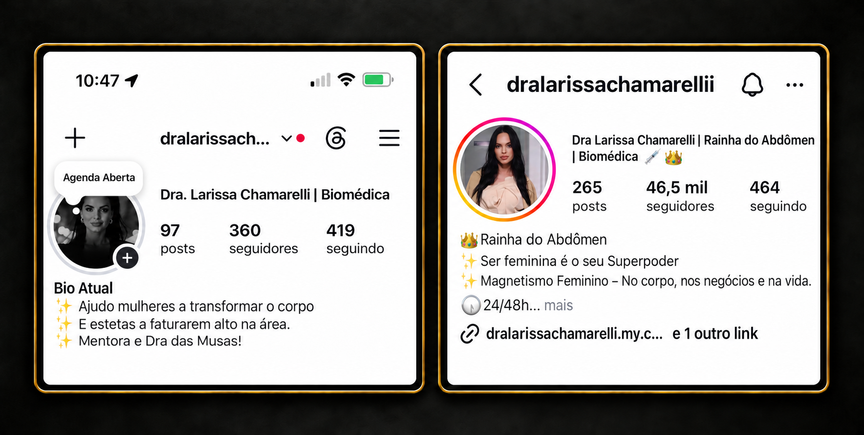Print antes e depois do perfil de Dra. Larissa Chamarelli